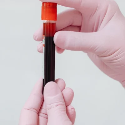 Pediatric Hematology 0