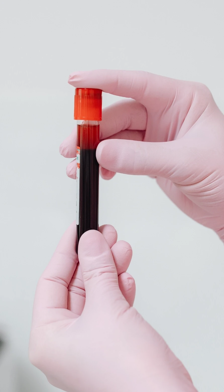 Pediatric Hematology 0